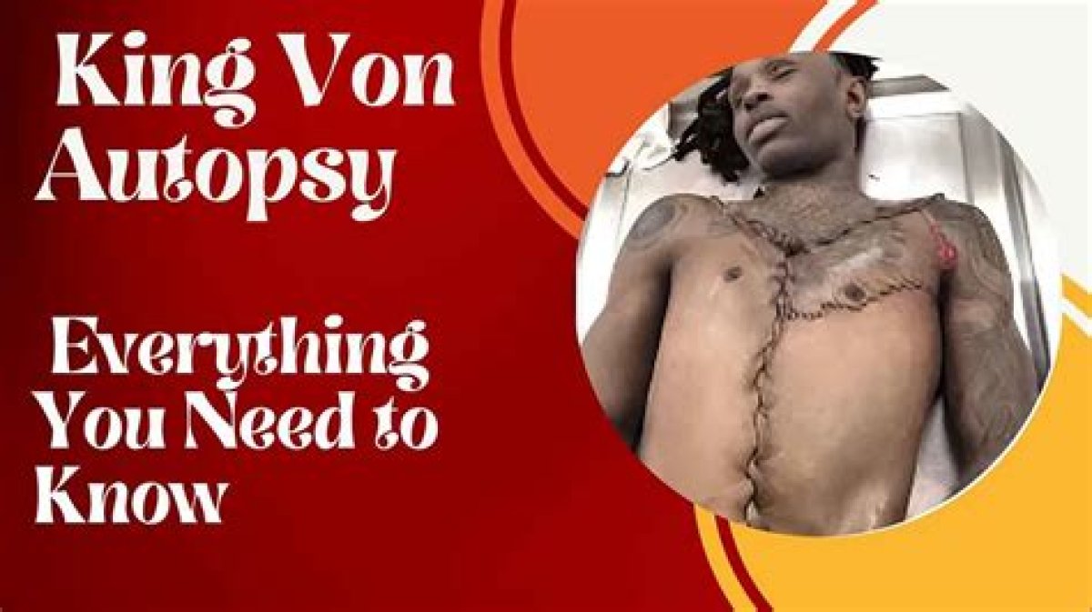 King Von Autopsy Results: Understanding the Impact of His Untimely Death