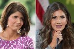 Kristi Noem Plastic Surgery: a Comprehensive Look